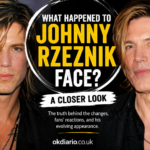 What Happened to Johnny Rzeznik Face? A Closer Look